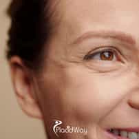 LASIK Eye Surgery in Puebla Mexico: Helping Patients Explore Clear Vision